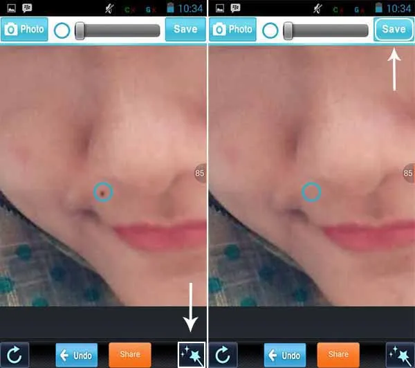 Cara Menghilangkan Jerawat di Android