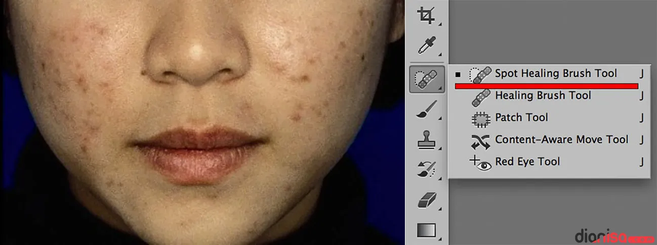 Membersihkan Jerawat Photoshop 1